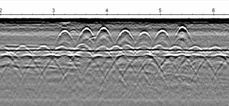 GPR2